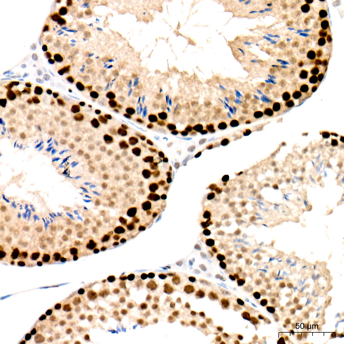 PCNA Rabbit mAb