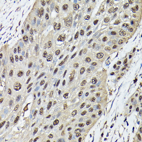 Ataxin-3 (ATXN3) Rabbit pAb