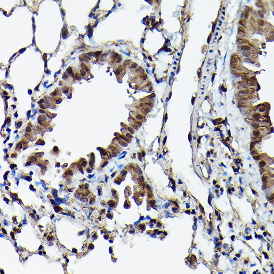 Ataxin-3 (ATXN3) Rabbit pAb