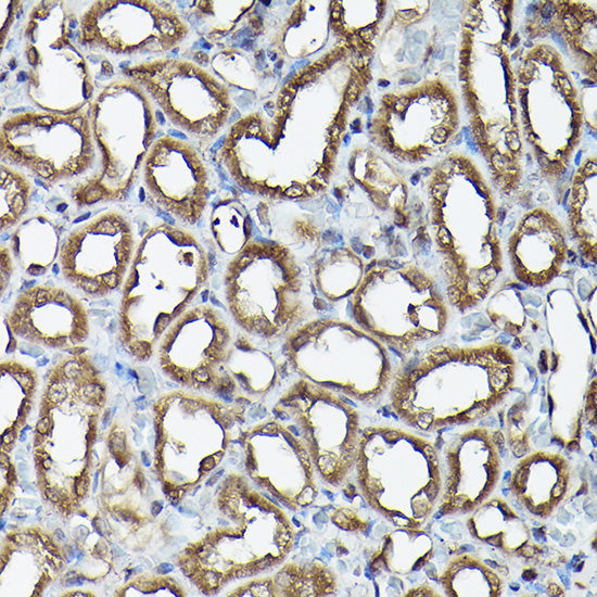 Ataxin-3 (ATXN3) Rabbit pAb