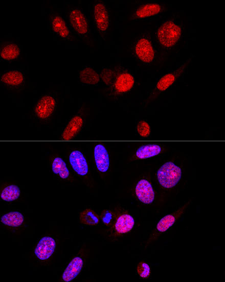 Ataxin-3 (ATXN3) Rabbit pAb