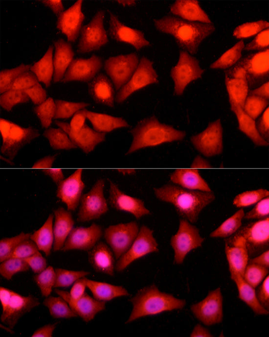 Ataxin-3 (ATXN3) Rabbit pAb