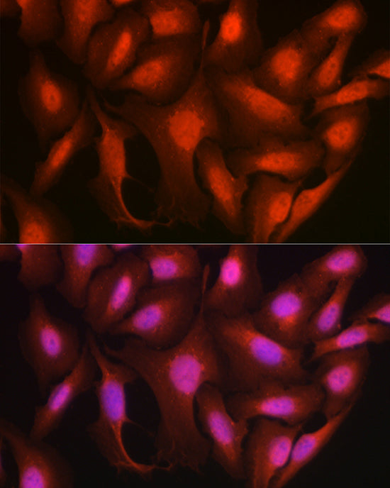 Ataxin-3 (ATXN3) Rabbit pAb