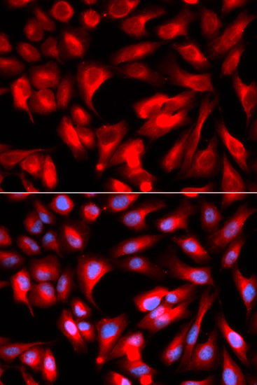 [KO Validated] CD168/RHAMM Rabbit pAb