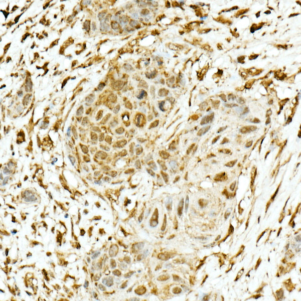 NRF2 Rabbit pAb