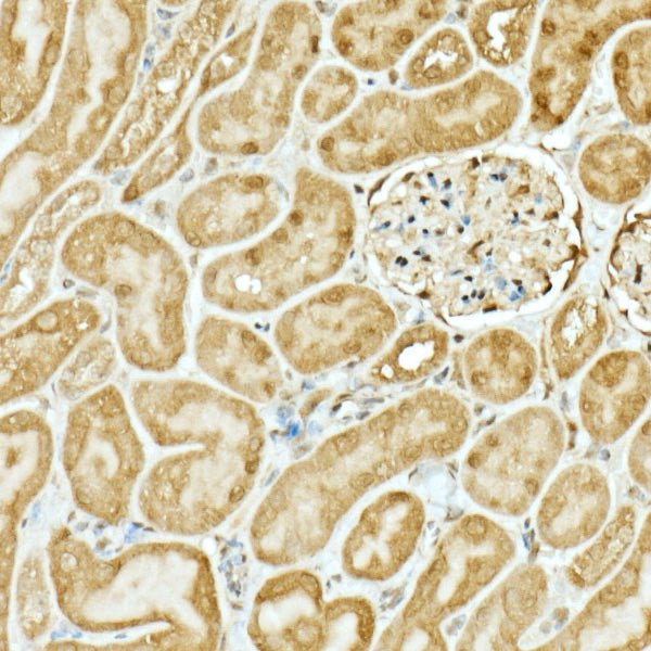 NRF2 Rabbit pAb