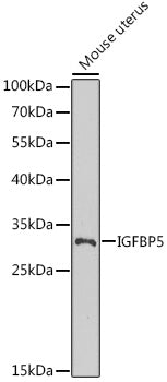 IGFBP5 Rabbit pAb