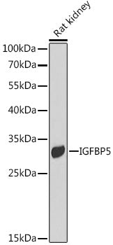 IGFBP5 Rabbit pAb