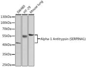 Alpha-1 Antitrypsin (SERPINA1) Rabbit pAb