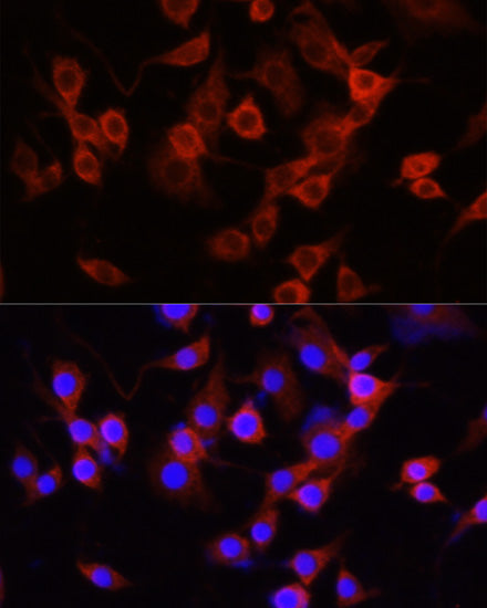 Alpha-1 Antitrypsin (SERPINA1) Rabbit pAb