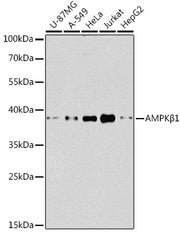 [KO Validated] AMPKβ1 Rabbit pAb
