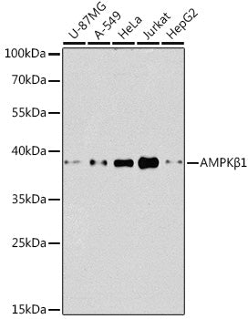 [KO Validated] AMPKβ1 Rabbit pAb