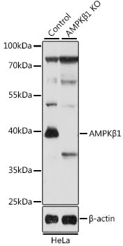 [KO Validated] AMPKβ1 Rabbit pAb