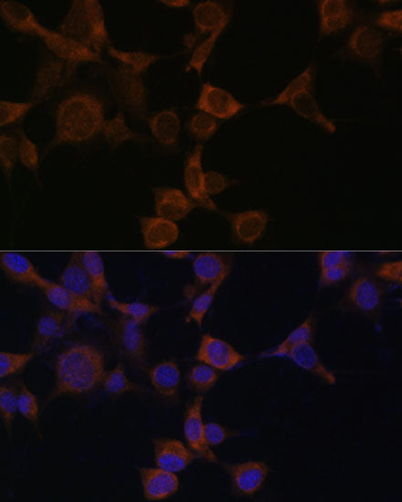 [KO Validated] AMPKβ1 Rabbit pAb