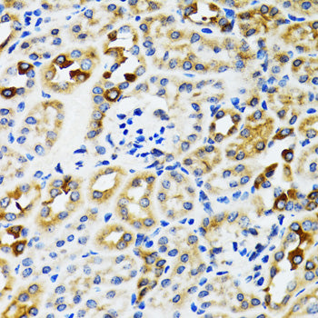 RPN1 Rabbit pAb