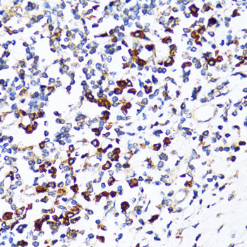 RPN1 Rabbit pAb