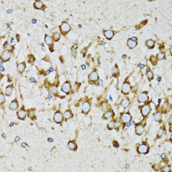RPN1 Rabbit pAb