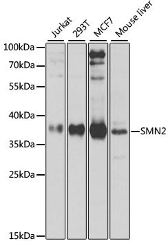 SMN2 Rabbit pAb