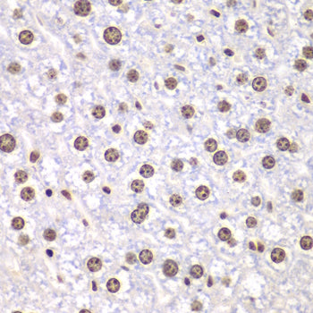 DNA topoisomerase I (TOP1) Rabbit pAb