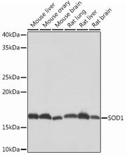 [KD Validated] SOD1 Rabbit mAb
