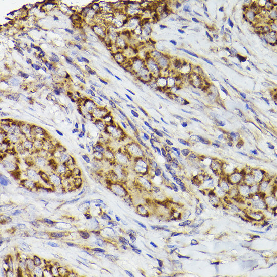 COX2/PTGS2 Rabbit pAb
