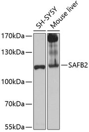 SAFB2 Rabbit pAb