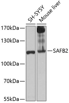 SAFB2 Rabbit pAb