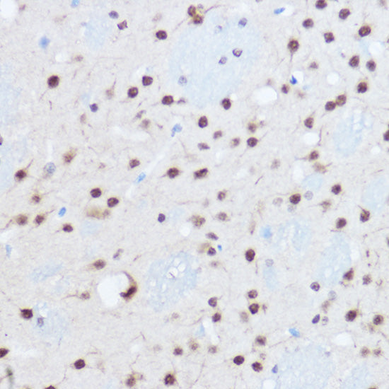 SAFB2 Rabbit pAb