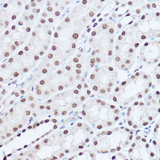 SAFB2 Rabbit pAb