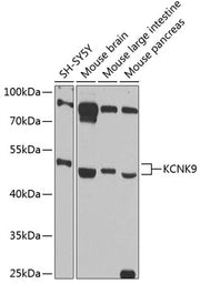 KCNK9 Rabbit pAb