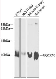 UQCR10 Rabbit pAb