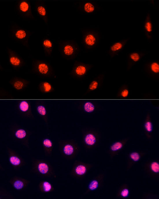 PRP19 Rabbit pAb