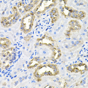 CDCA8 Rabbit pAb