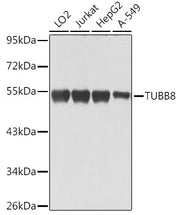 TUBB8 Rabbit pAb