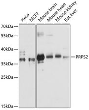 PRPS2 Rabbit pAb