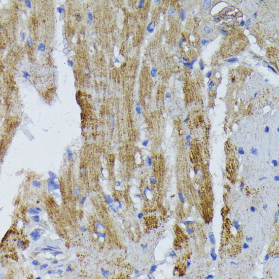 ACADL Rabbit pAb