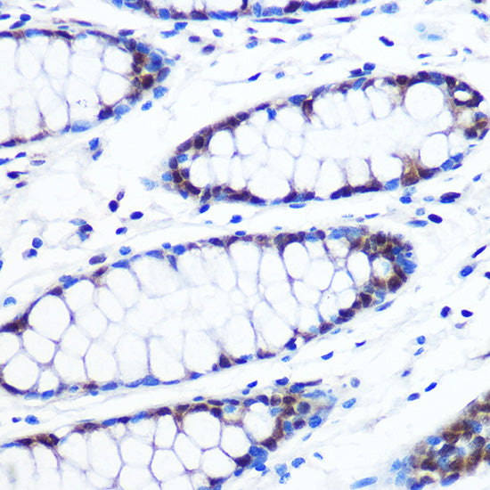 BRD4 Rabbit mAb