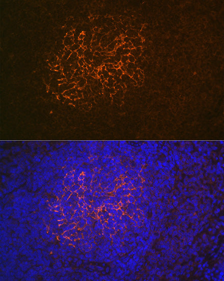 CR2/CD21 Rabbit mAb