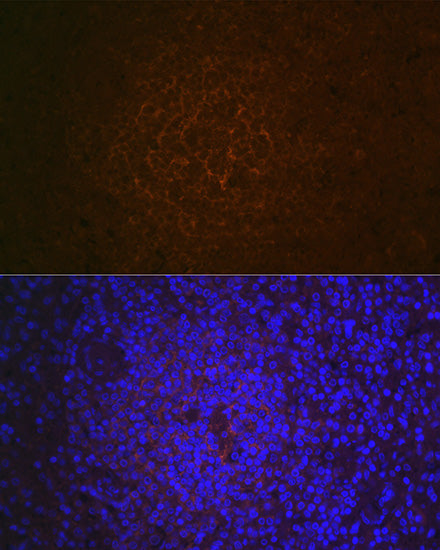 CR2/CD21 Rabbit mAb