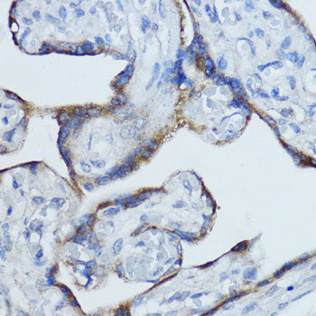 Aromatase (CYP19A1) Rabbit pAb