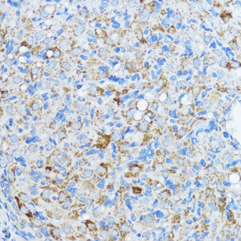 Aromatase (CYP19A1) Rabbit pAb