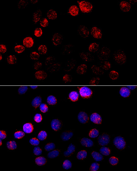 Aromatase (CYP19A1) Rabbit pAb