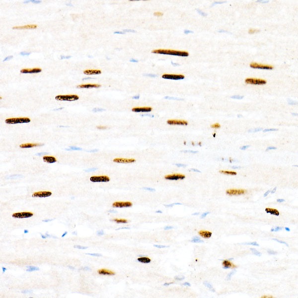 FOXP1 Rabbit pAb