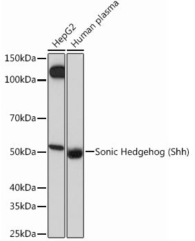 Sonic Hedgehog (Shh) Rabbit mAb
