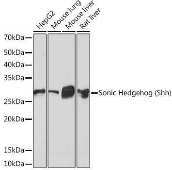 Sonic Hedgehog (Shh) Rabbit mAb