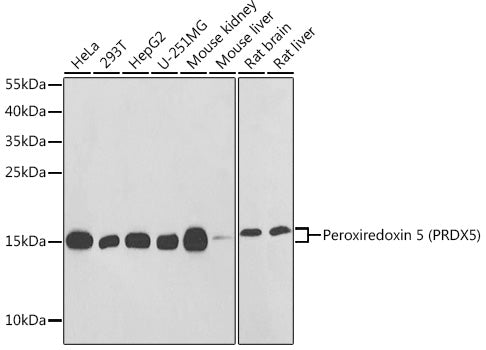 Peroxiredoxin 5 (PRDX5) Rabbit pAb