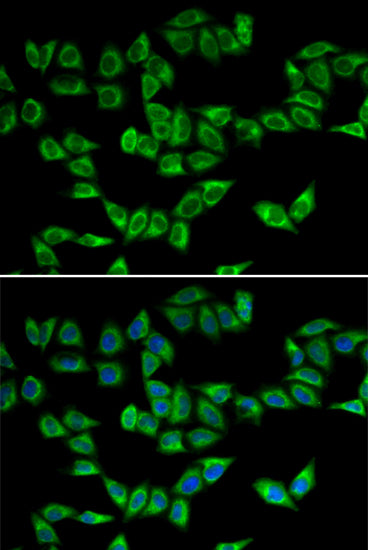 Peroxiredoxin 5 (PRDX5) Rabbit pAb