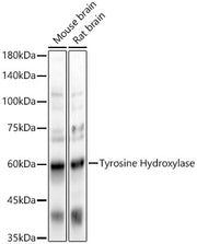 Tyrosine Hydroxylase Rabbit pAb