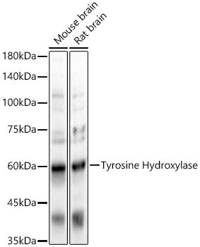 Tyrosine Hydroxylase Rabbit pAb