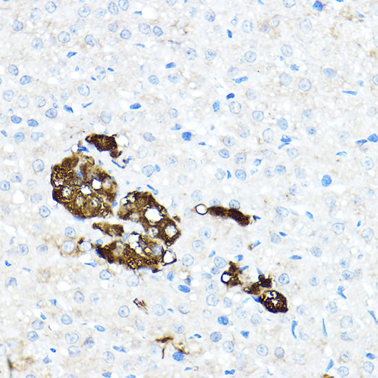 Tyrosine Hydroxylase Rabbit pAb